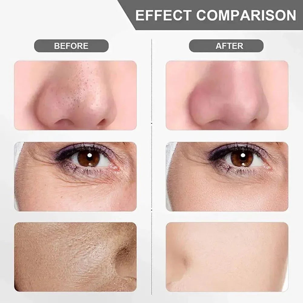 Ultrasonic Facial Skin Scrubber – Deep Cleanse & Glowing Skin in Minutes!