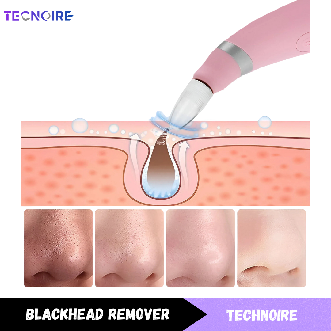 Black Head Remover